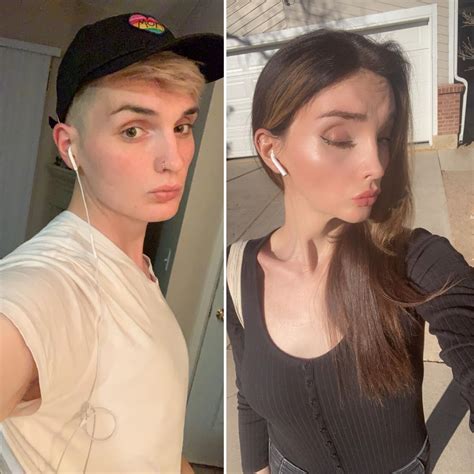 femboy breast|Feminizing Top Surgery Before & After Pictures